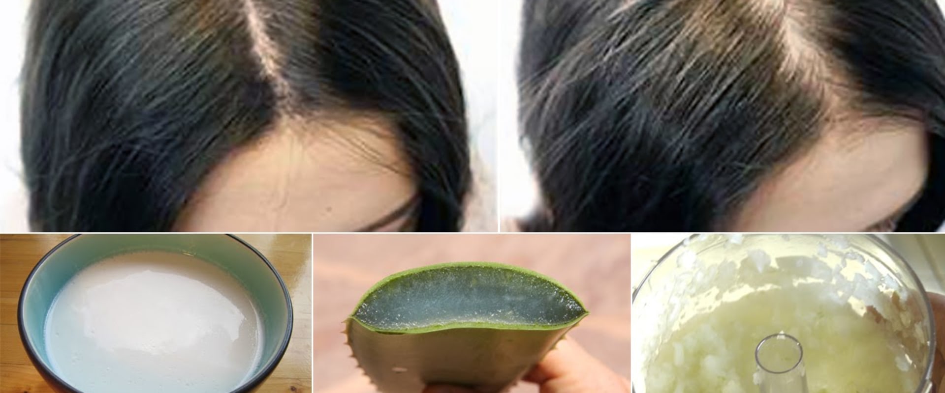 The Best Home Remedies for Hair Loss: Natural Solutions to Reduce Hair Loss and Stimulate Hair Growth