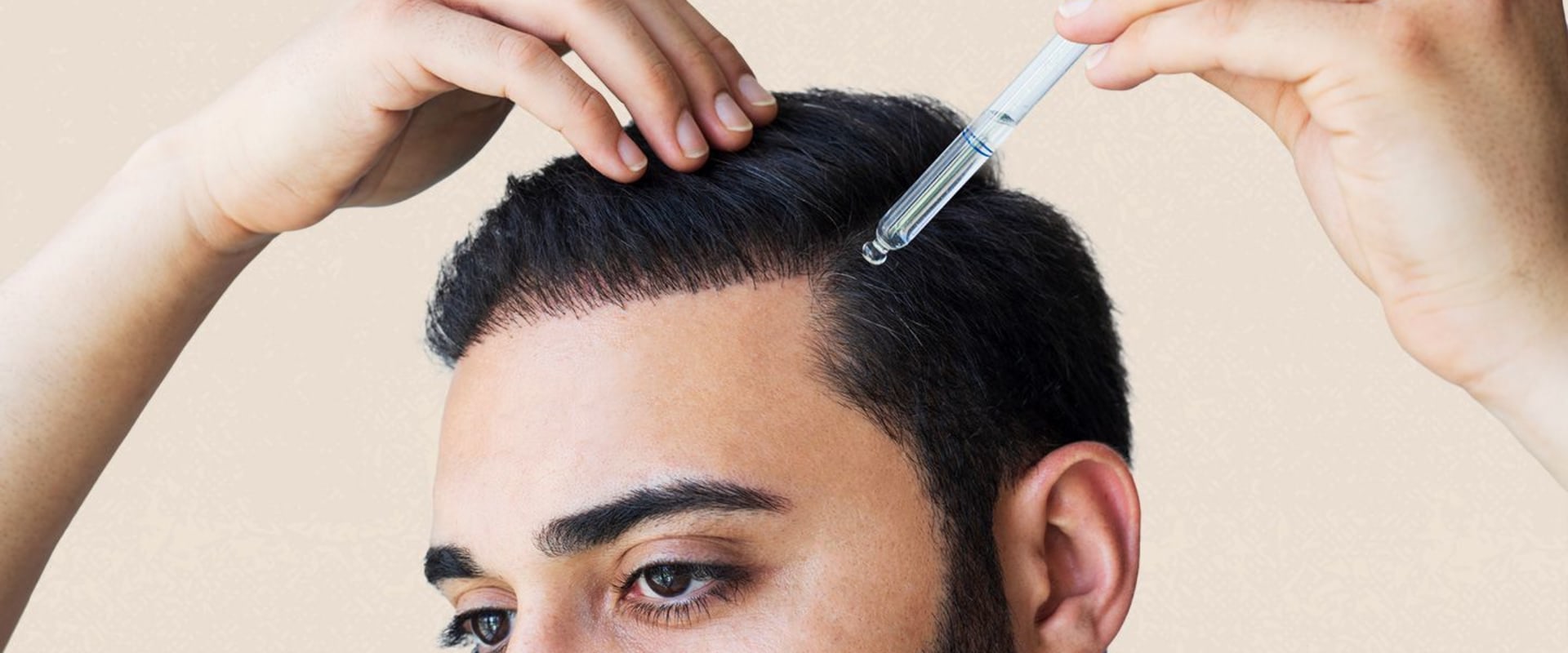 The Big Three Hair Loss Treatments: What You Need to Know