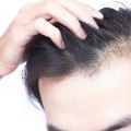 What to Do When Experiencing Sudden or Unexpected Hair Loss