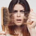 Everything You Need to Know About Hair Loss