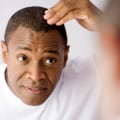 Understanding Hair Loss: Causes, Treatments and Prevention