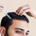 The Big Three Hair Loss Treatments: What You Need to Know