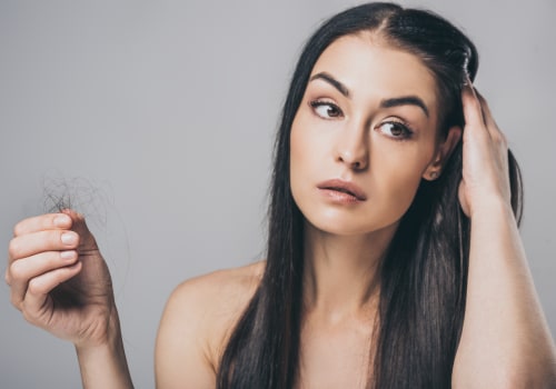 Reversing Female Hormonal Hair Loss: What You Need to Know