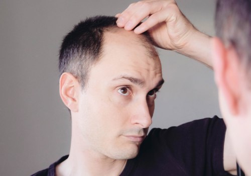 Preventing Hair Loss: The Best Lifestyle Changes to Stop Hair Loss