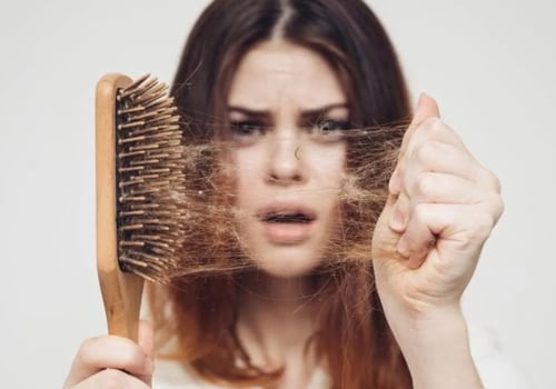 Everything You Need to Know About Hair Loss