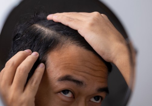 Will Hair Loss Due to Diet Grow Back? - A Comprehensive Guide