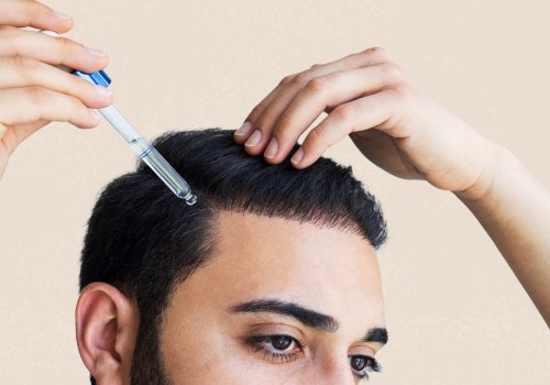 The Big Three Hair Loss Treatments: What You Need to Know